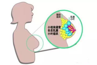 乳腺增生揉与不揉的科学解析与建议