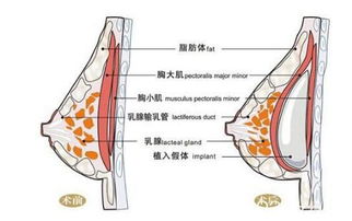 脑萎缩严重程度