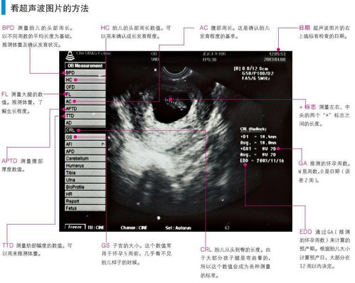 孕期探索，揭秘三个月胎儿的奇妙世界——从超声波图像看胎宝宝的成长与发育