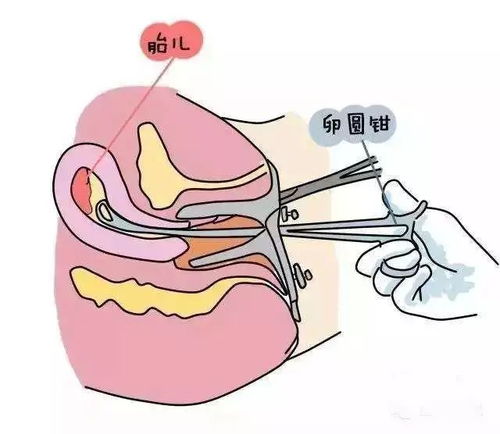 全面解读，从性行为到怀孕的女子生理图解——科学与关爱的结合