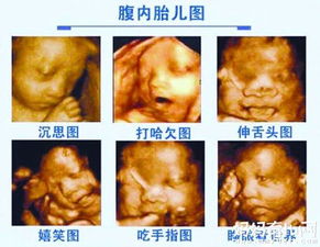 揭秘孕期守护神——7个月四维彩超，全方位了解与科学应用