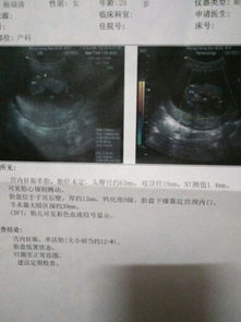 揭秘！孕期B超如何精准判断胎儿性别，科学解析全程指南